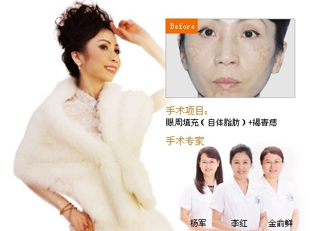 自体脂肪填充,吉林铭医