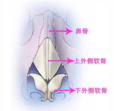 猪鼻子,隆鼻,吉林铭医 猪鼻子,隆鼻,吉林铭医