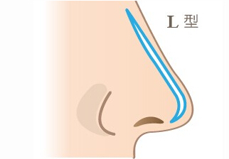 猪鼻子,隆鼻,吉林铭医 猪鼻子,隆鼻,吉林铭医