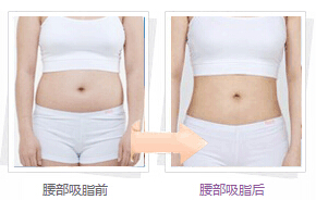 宠物,狗瑜伽,减肥,水动力吸脂