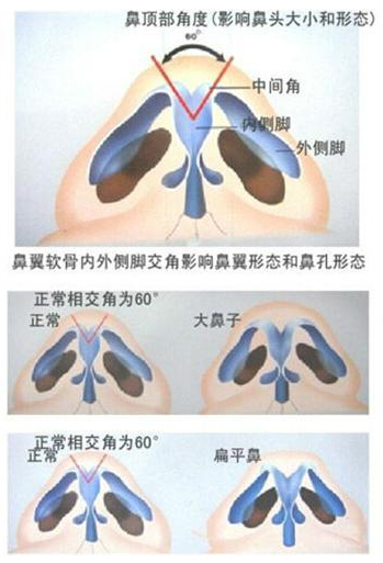 鼻综合整形,图解,长春好的整形医院
