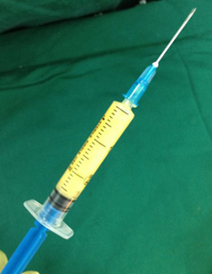 注射,微整形,长春好的整形医院