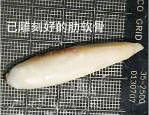 隆鼻,材料,自体肋软骨,长春好的整形医院