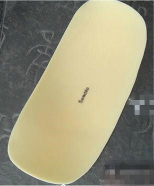 假体,丰额头,长春好整形的医院