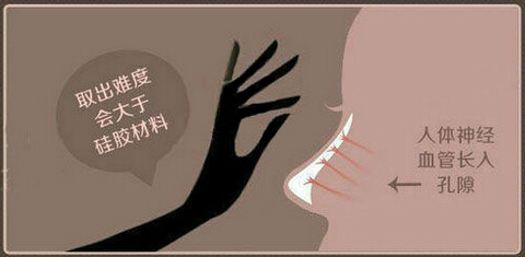 一分钟,读懂,膨体隆鼻,长春好的整形医院