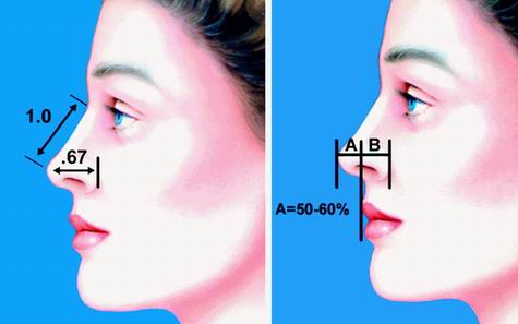 精致隆鼻,参数,长春好的整形医院