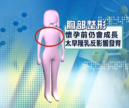 18岁以下,整形,长春好的整形医院