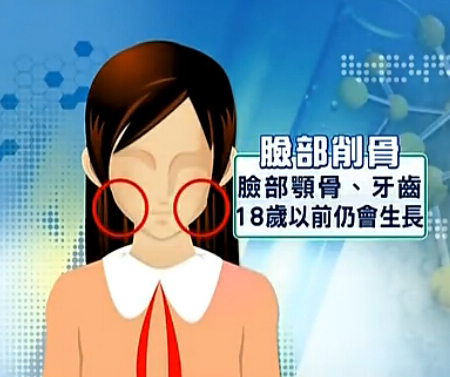 18岁以下,整形,长春好的整形医院