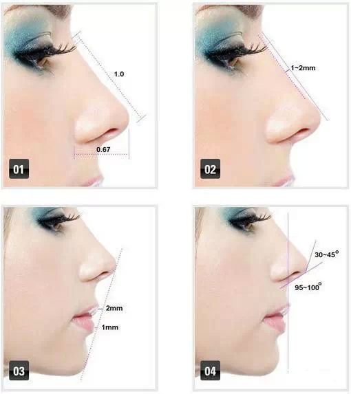 美鼻,标准,长春好的整形医院