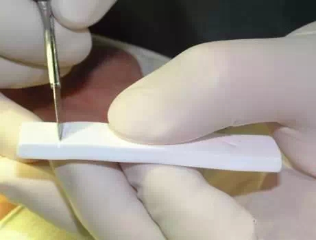 隆鼻材料,膨体,长春好的整形医院