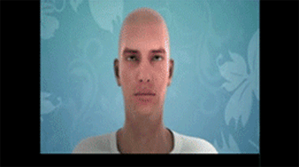 模拟,隆下巴,长春好的整形医院