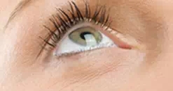 眼袋类型,松弛型,长春好的整形医院