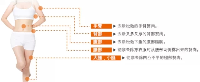 accu激光溶脂,长春海峡整形,海峡整形,海峡医学美容,海峡整形美容