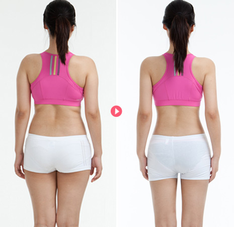 长春铭医吸脂;长春吸脂减肥,水动力吸脂