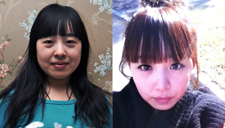 长春瘦脸,长春除皱,长春祛斑,长春隆鼻