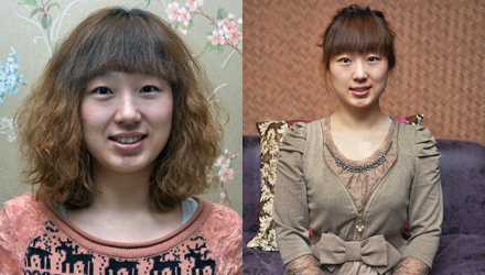 长春瘦脸,长春除皱,长春祛斑,长春隆鼻