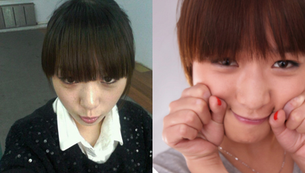 长春瘦脸,长春除皱,长春祛斑,长春隆鼻