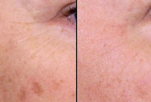 长春激光疗法,长春好的整形医院